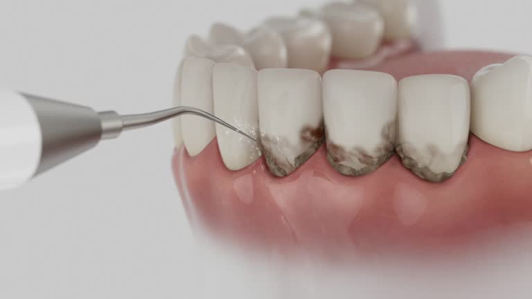 Reliable Dental Implants contractor in Cochituate, MA by Smile Center Dentistry